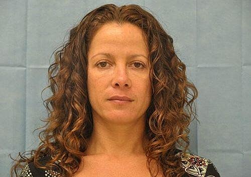 Botox Before & After